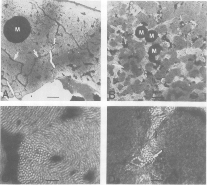 Contained in orderly arrays in the bones and teeth